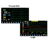 Przenośny sprzęt do monitorowania anestezjologii Analizator tlenu TFT 15,6&quot; LCD